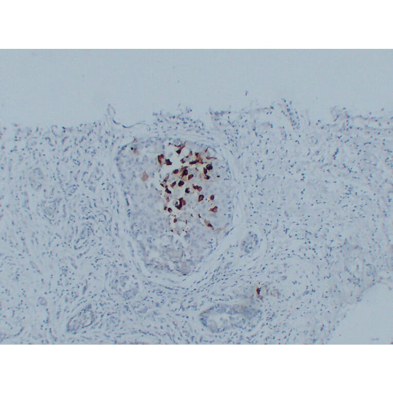 Immunohistochemistry - Anti-Mammaglobin Antibody (V0091) - Antibodies.com