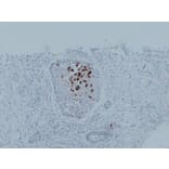 Immunohistochemistry - Anti-Mammaglobin Antibody (V0091) - Antibodies.com