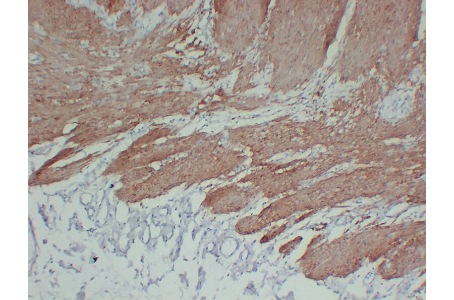 Immunohistochemistry - Anti-Calponin 1 Antibody (V0013) - Antibodies.com