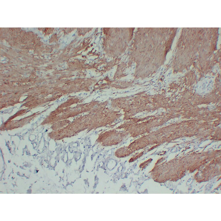 Immunohistochemistry - Anti-Calponin 1 Antibody (V0013) - Antibodies.com