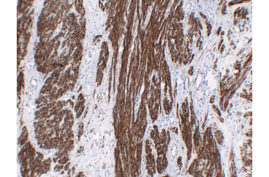 Immunohistochemistry - Anti-Calponin 1 Antibody (V0013) - Antibodies.com