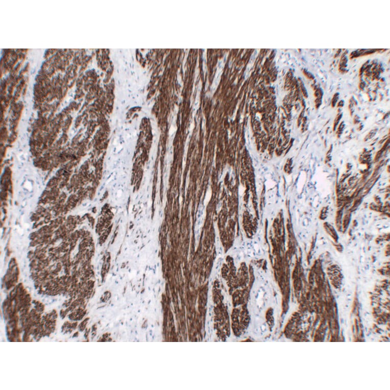 Immunohistochemistry - Anti-Calponin 1 Antibody (V0013) - Antibodies.com