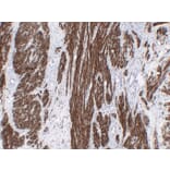 Immunohistochemistry - Anti-Calponin 1 Antibody (V0013) - Antibodies.com