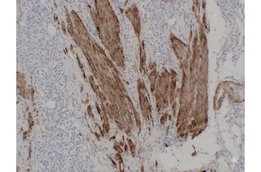 Immunohistochemistry - Anti-Calponin 1 Antibody (V0013) - Antibodies.com