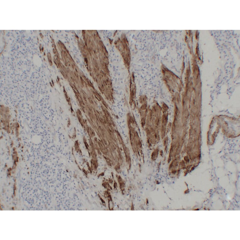 Immunohistochemistry - Anti-Calponin 1 Antibody (V0013) - Antibodies.com