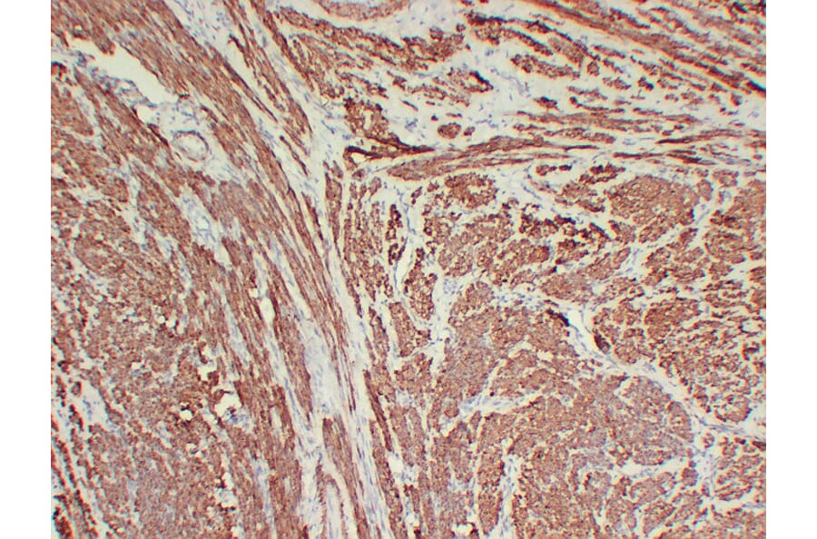 Immunohistochemistry - Anti-Calponin 1 Antibody (V0013) - Antibodies.com