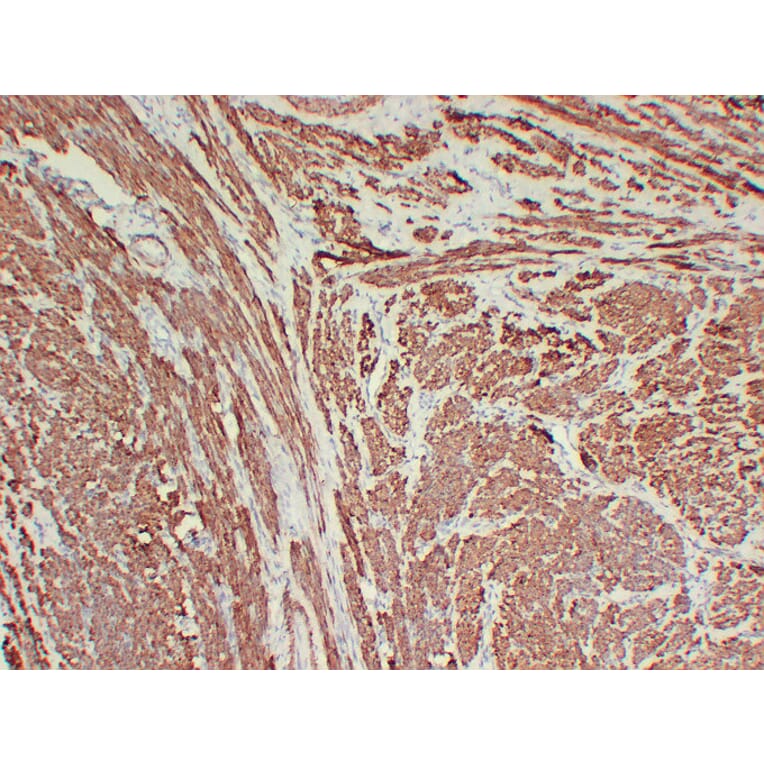 Immunohistochemistry - Anti-Calponin 1 Antibody (V0013) - Antibodies.com