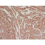 Immunohistochemistry - Anti-Calponin 1 Antibody (V0013) - Antibodies.com