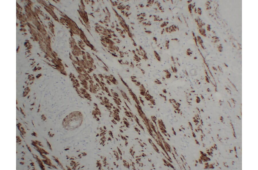 Immunohistochemistry - Anti-Calponin 1 Antibody (V0013) - Antibodies.com