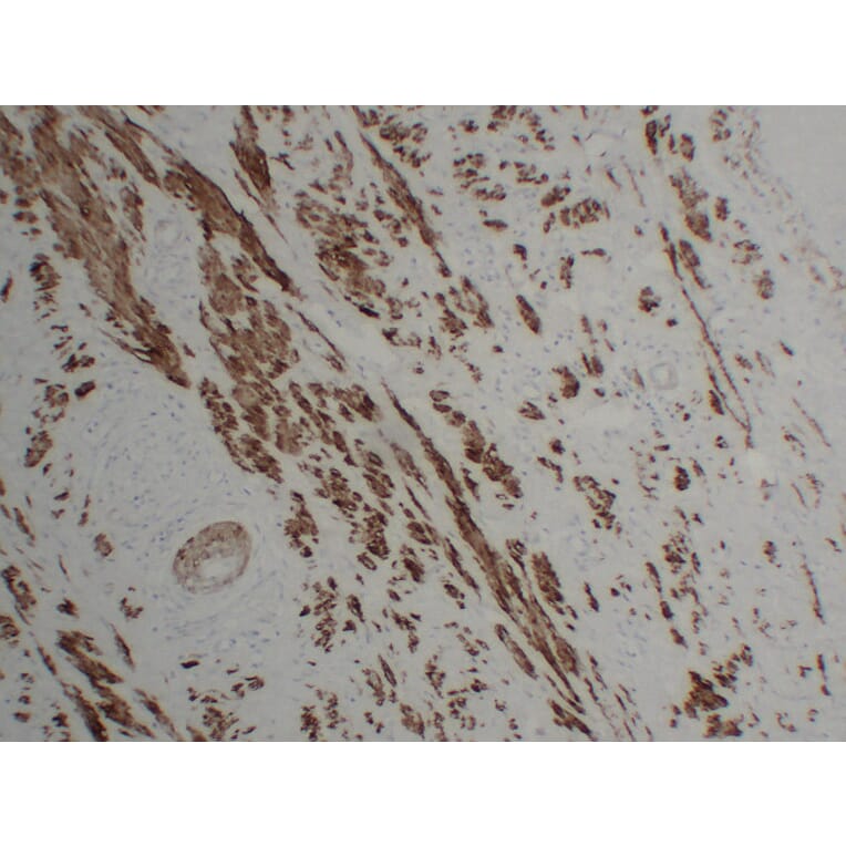 Immunohistochemistry - Anti-Calponin 1 Antibody (V0013) - Antibodies.com