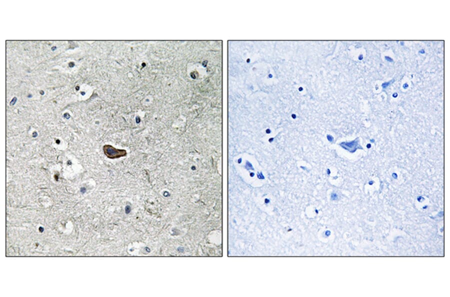 Immunohistochemistry - Anti-PKC delta Antibody (B7196) - Antibodies.com