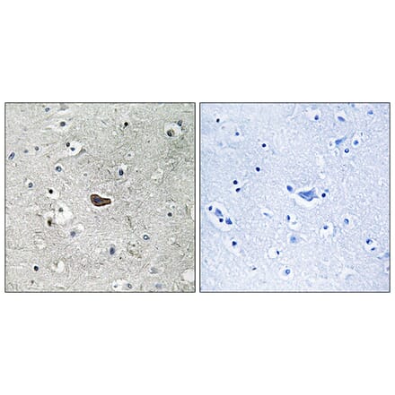 Immunohistochemistry - Anti-PKC delta Antibody (B7196) - Antibodies.com