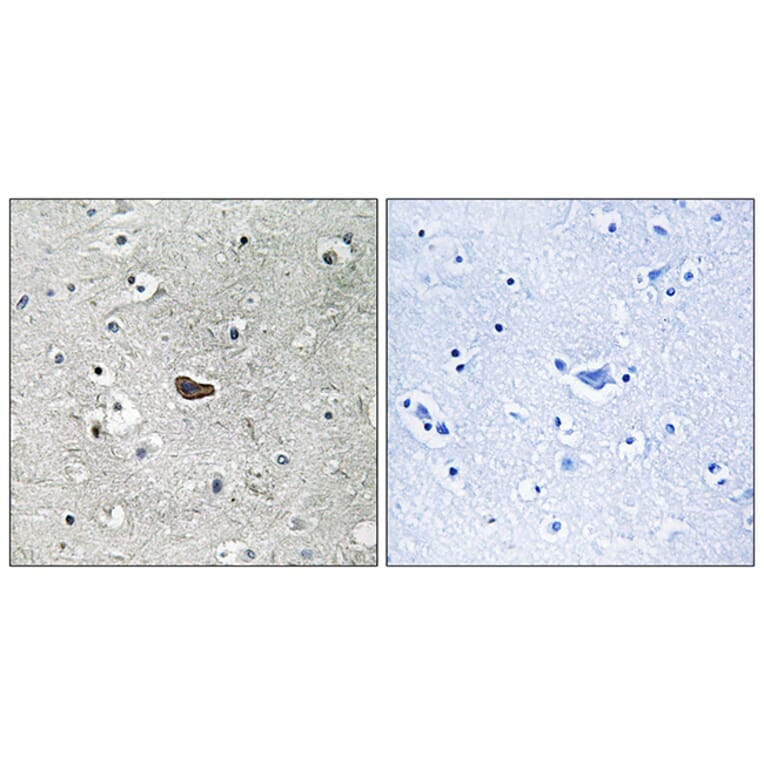 Immunohistochemistry - Anti-PKC delta Antibody (B7196) - Antibodies.com