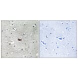 Immunohistochemistry - Anti-PKC delta Antibody (B7196) - Antibodies.com