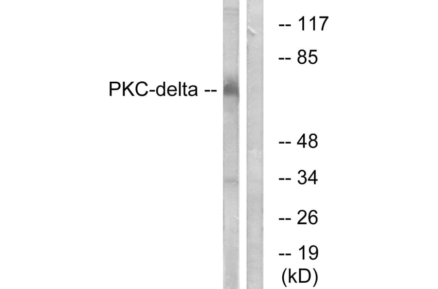 Western Blot - Anti-PKC delta Antibody (B7196) - Antibodies.com