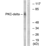 Western Blot - Anti-PKC delta Antibody (B7196) - Antibodies.com
