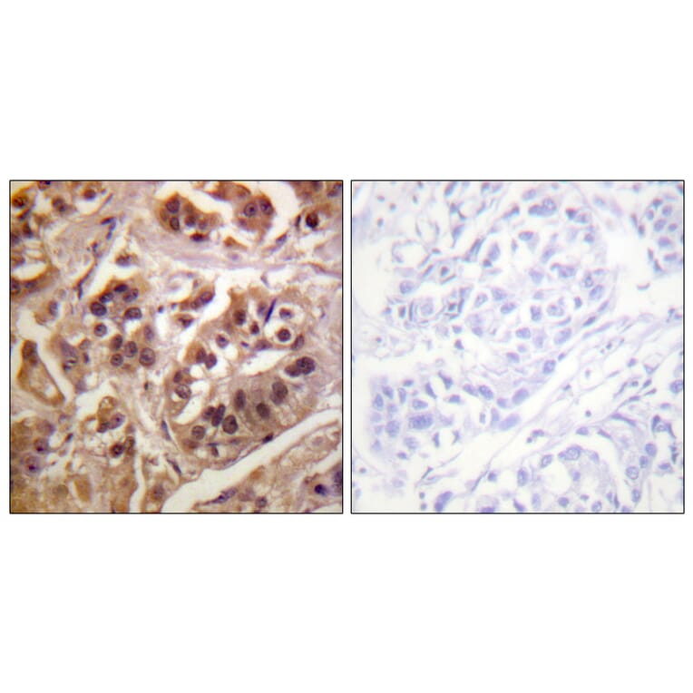 Immunohistochemistry - Anti-IKK-gamma Antibody (B0443) - Antibodies.com