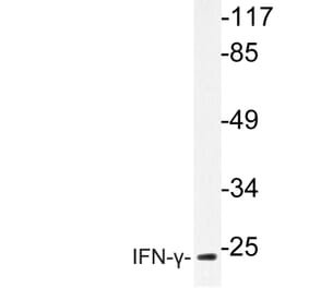 Western Blot - Anti-IFN-gamma Antibody (R12-2193) - Antibodies.com