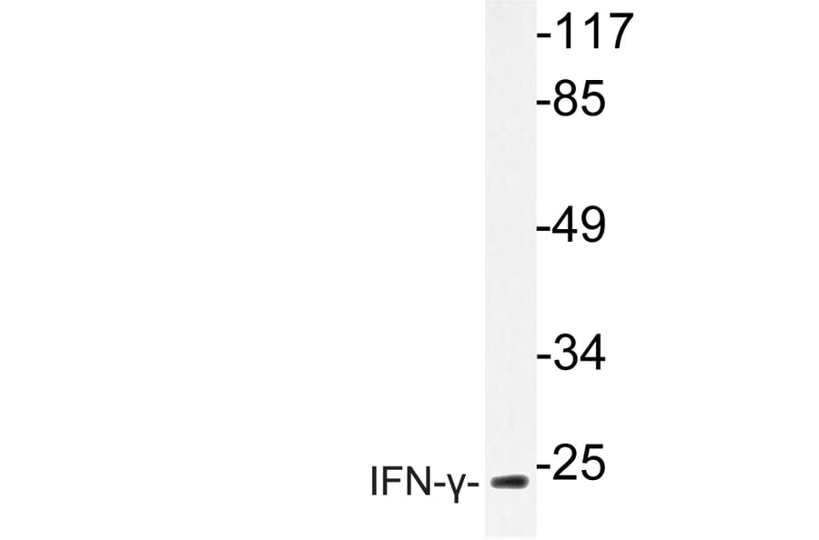 Western Blot - Anti-IFN-gamma Antibody (R12-2193) - Antibodies.com
