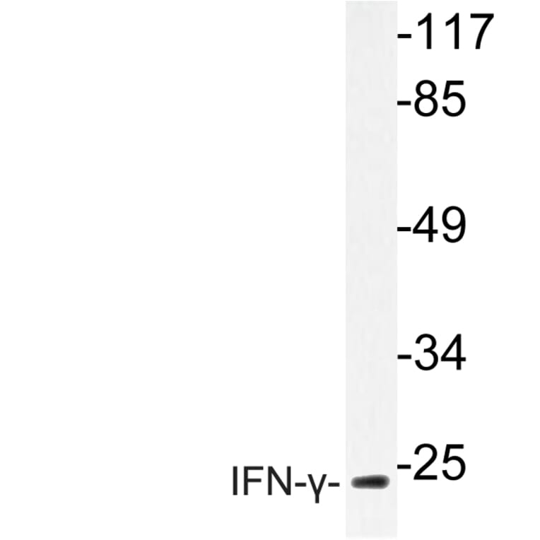 Western Blot - Anti-IFN-gamma Antibody (R12-2193) - Antibodies.com