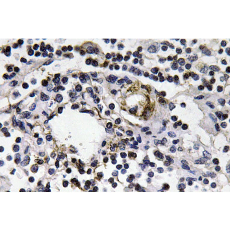 Immunohistochemistry - Anti-IFN-gamma Antibody (R12-2193) - Antibodies.com