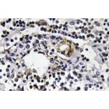Immunohistochemistry - Anti-IFN-gamma Antibody (R12-2193) - Antibodies.com