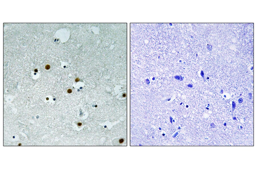 Immunohistochemistry - Anti-HP1 alpha Antibody (B8262) - Antibodies.com