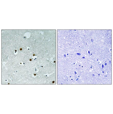 Immunohistochemistry - Anti-HP1 alpha Antibody (B8262) - Antibodies.com