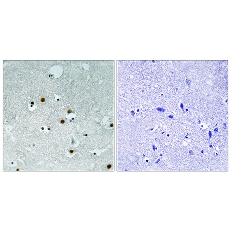 Immunohistochemistry - Anti-HP1 alpha Antibody (B8262) - Antibodies.com