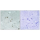 Immunohistochemistry - Anti-HP1 alpha Antibody (B8262) - Antibodies.com