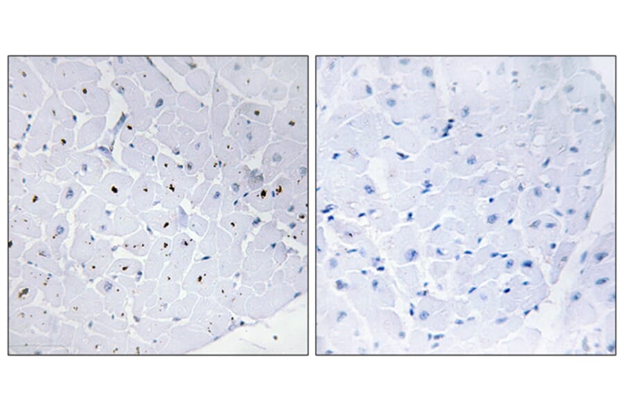 Immunohistochemistry - Anti-Cyclin E1 Antibody (B0636) - Antibodies.com