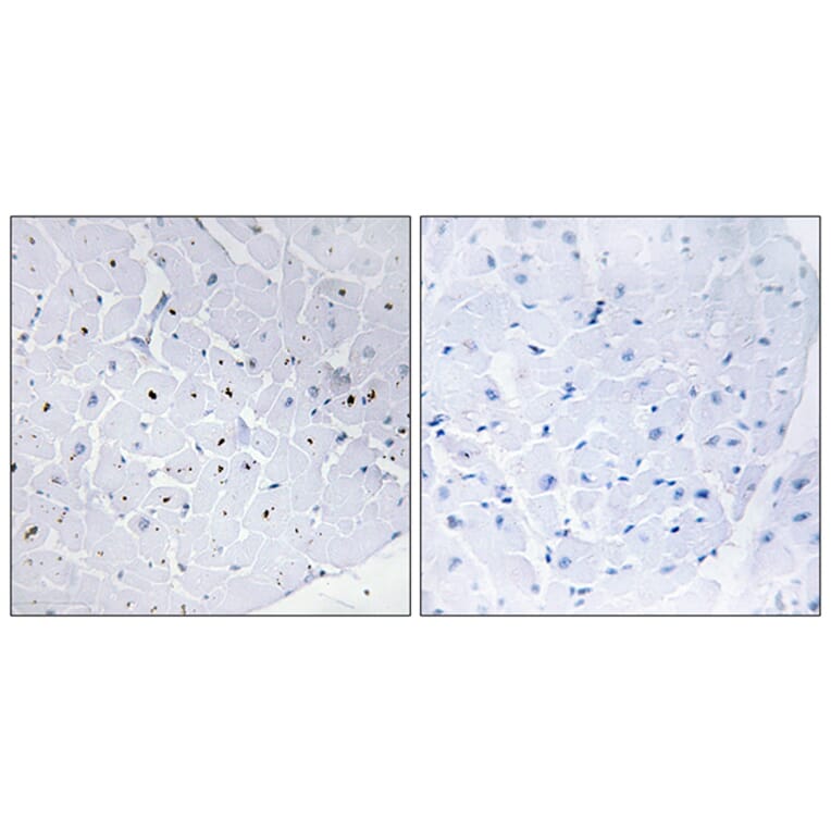 Immunohistochemistry - Anti-Cyclin E1 Antibody (B0636) - Antibodies.com