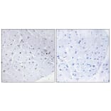 Immunohistochemistry - Anti-Cyclin E1 Antibody (B0636) - Antibodies.com