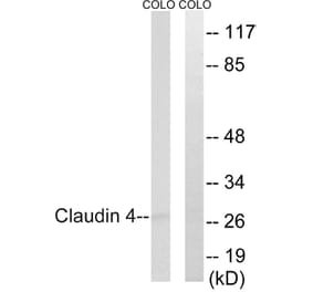 Western Blot - Anti-Claudin 4 Antibody (B8318) - Antibodies.com