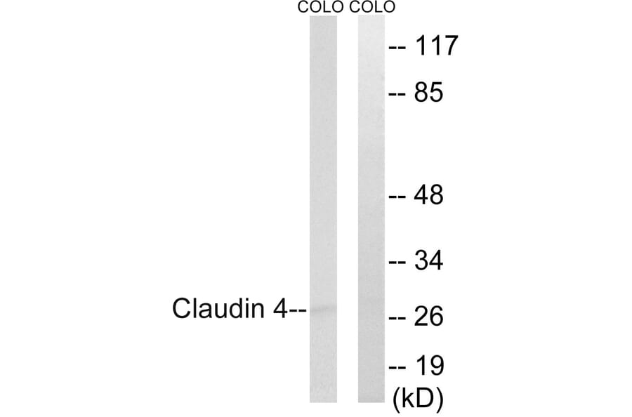 Western Blot - Anti-Claudin 4 Antibody (B8318) - Antibodies.com