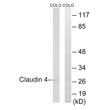 Western Blot - Anti-Claudin 4 Antibody (B8318) - Antibodies.com