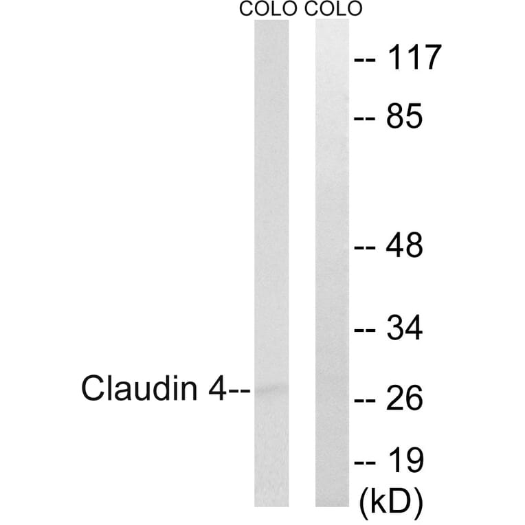 Western Blot - Anti-Claudin 4 Antibody (B8318) - Antibodies.com