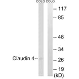 Western Blot - Anti-Claudin 4 Antibody (B8318) - Antibodies.com