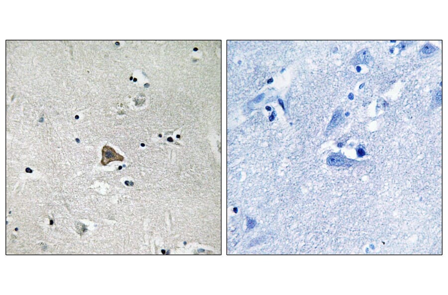 Immunohistochemistry - Anti-Claudin 4 Antibody (B8318) - Antibodies.com