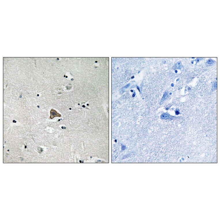 Immunohistochemistry - Anti-Claudin 4 Antibody (B8318) - Antibodies.com