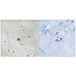 Immunohistochemistry - Anti-Claudin 4 Antibody (B8318) - Antibodies.com