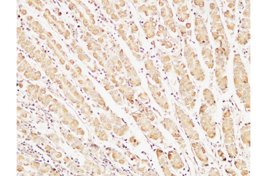 Immunohistochemistry - Anti-Caspase-7 Antibody (R12-2055) - Antibodies.com