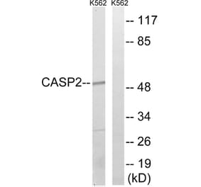 Western Blot - Anti-Caspase 2 Antibody (B1026) - Antibodies.com