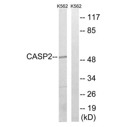 Western Blot - Anti-Caspase 2 Antibody (B1026) - Antibodies.com