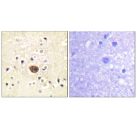 Immunohistochemistry - Anti-Ras-GRF1 Antibody (B0728) - Antibodies.com