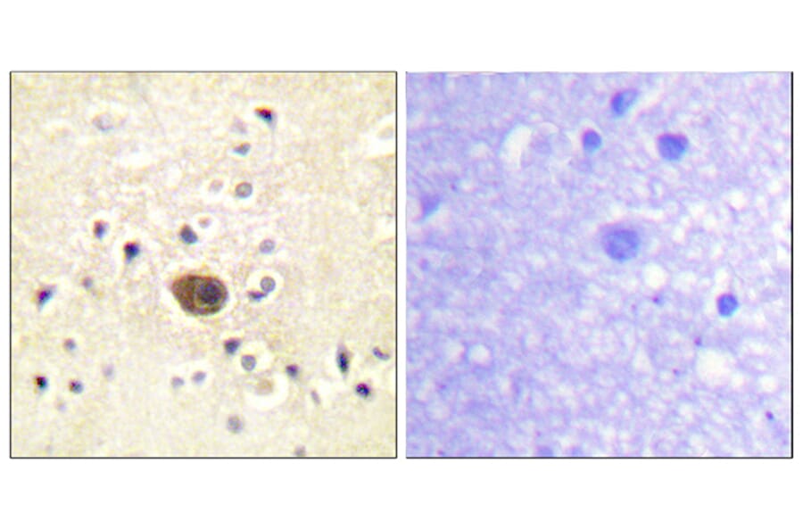 Immunohistochemistry - Anti-Ras-GRF1 Antibody (B0728) - Antibodies.com