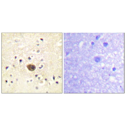 Immunohistochemistry - Anti-Ras-GRF1 Antibody (B0728) - Antibodies.com