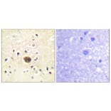 Immunohistochemistry - Anti-Ras-GRF1 Antibody (B0728) - Antibodies.com