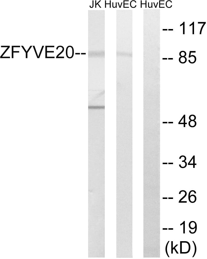 Western blot analysis of lysates from HUVEC and Jurkat cells using Anti-ZFYVE20 Antibody. The right hand lane represents a negative control, where the antibody is blocked by the immunising peptide.