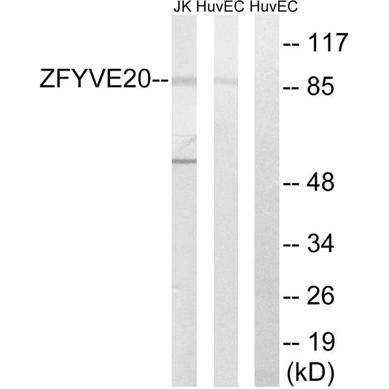 Western Blot - Anti-ZFYVE20 Antibody (C18130) - Antibodies.com